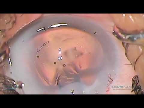 EYECRYL PLUS Natural HD_New