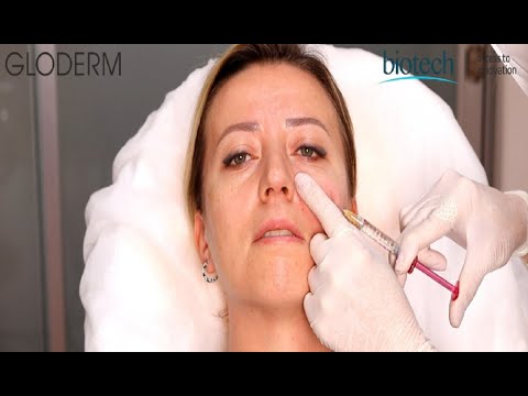 Gloderm | Under Eye Area
