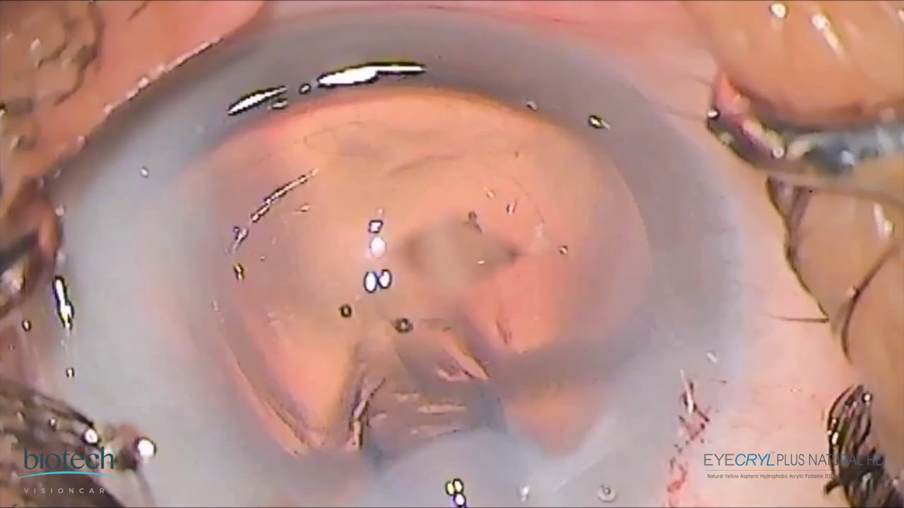 EYECRYL PLUS NATURAL HD