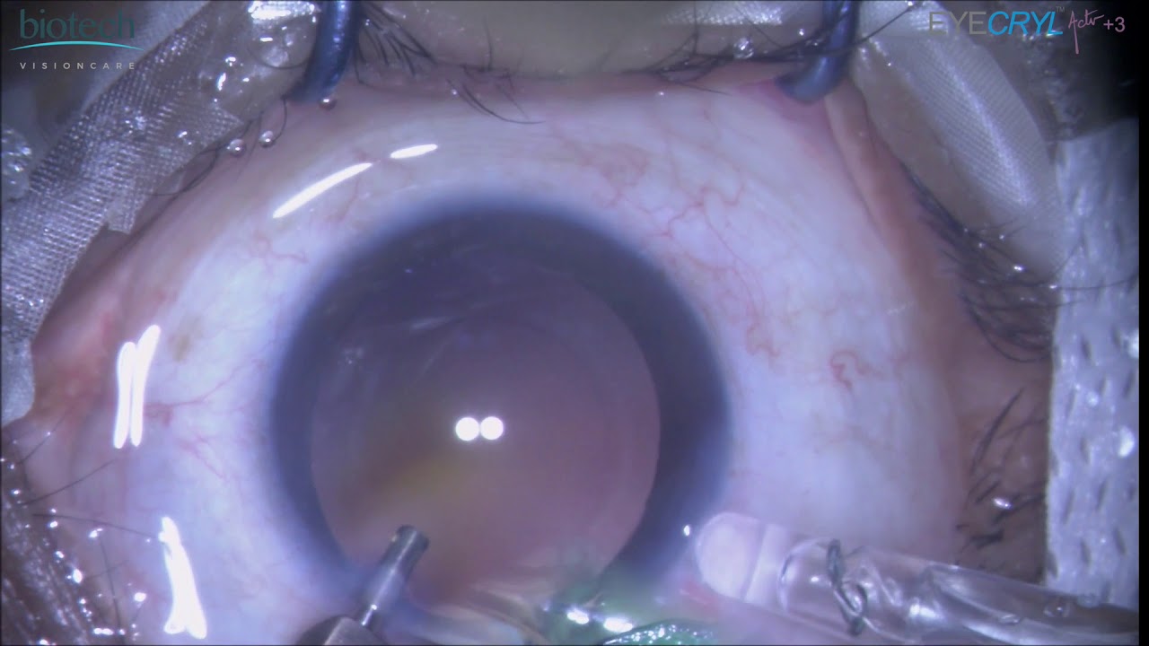 EYECRYL Actv +3