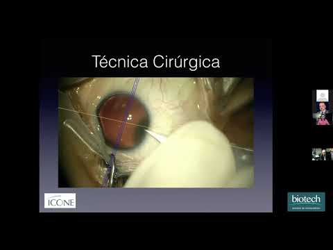 1st Impressions of Eyecryl Phakic by Dr Álvaro Dantas
