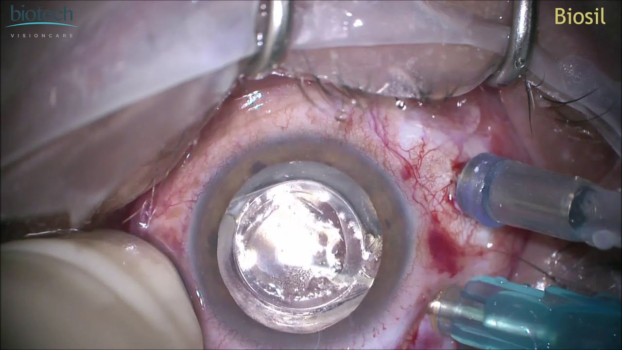 Biosil HDvideo