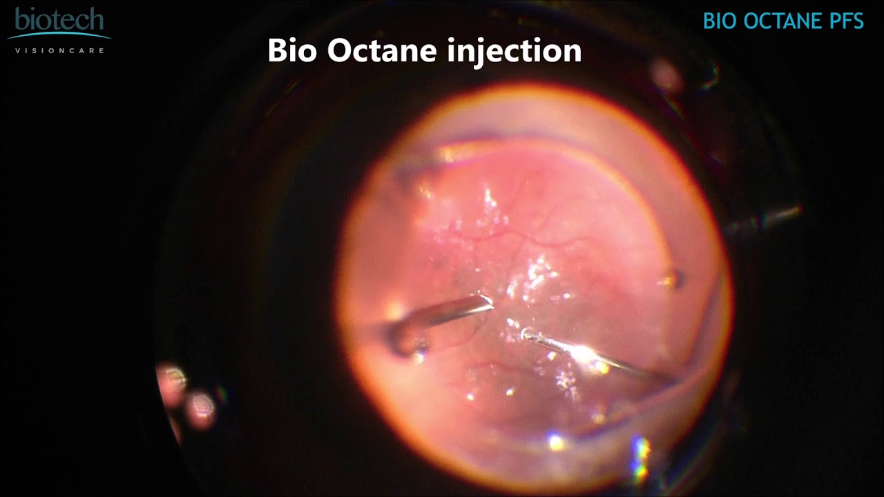 BioOctaneHDvideo