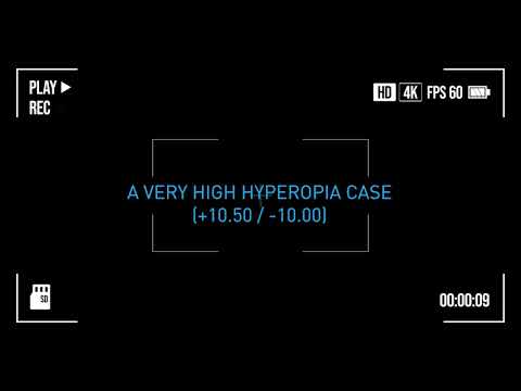 EYECRYL Phakic Challenging Cases : Dr. Mohamad Ramzy