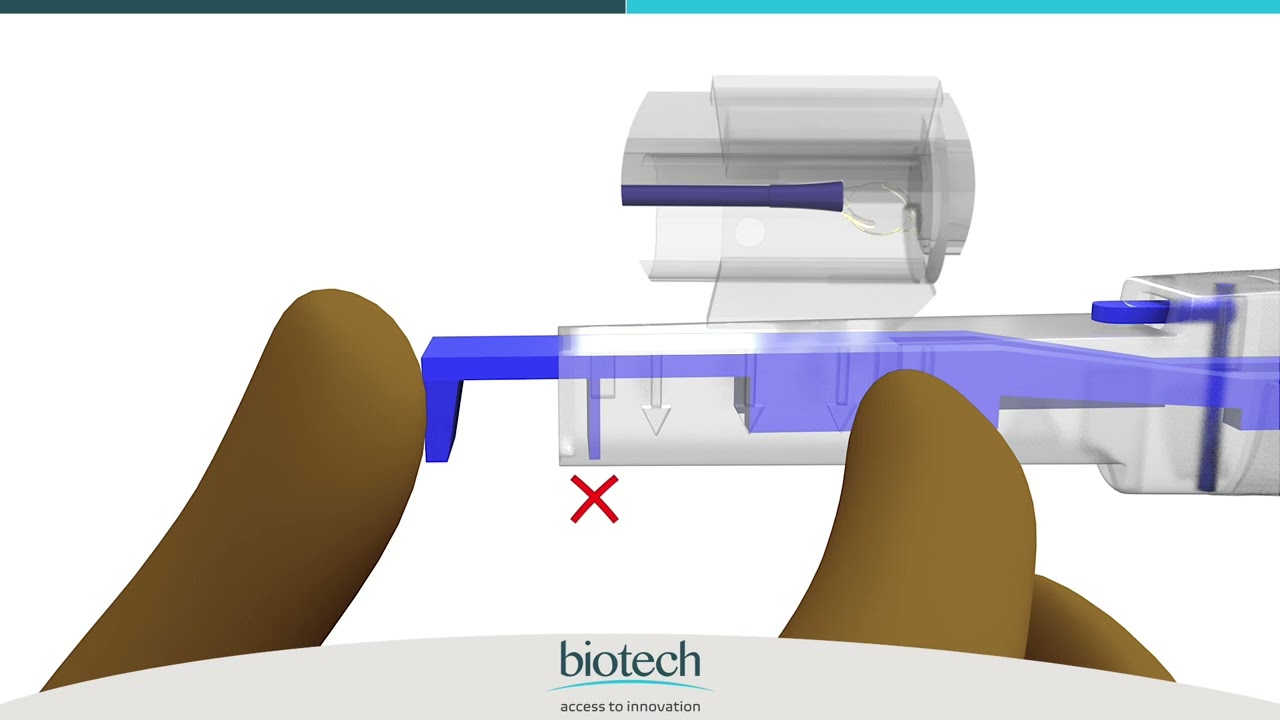 Optiflex Xtense Comfort Plus – Delivery System Animation