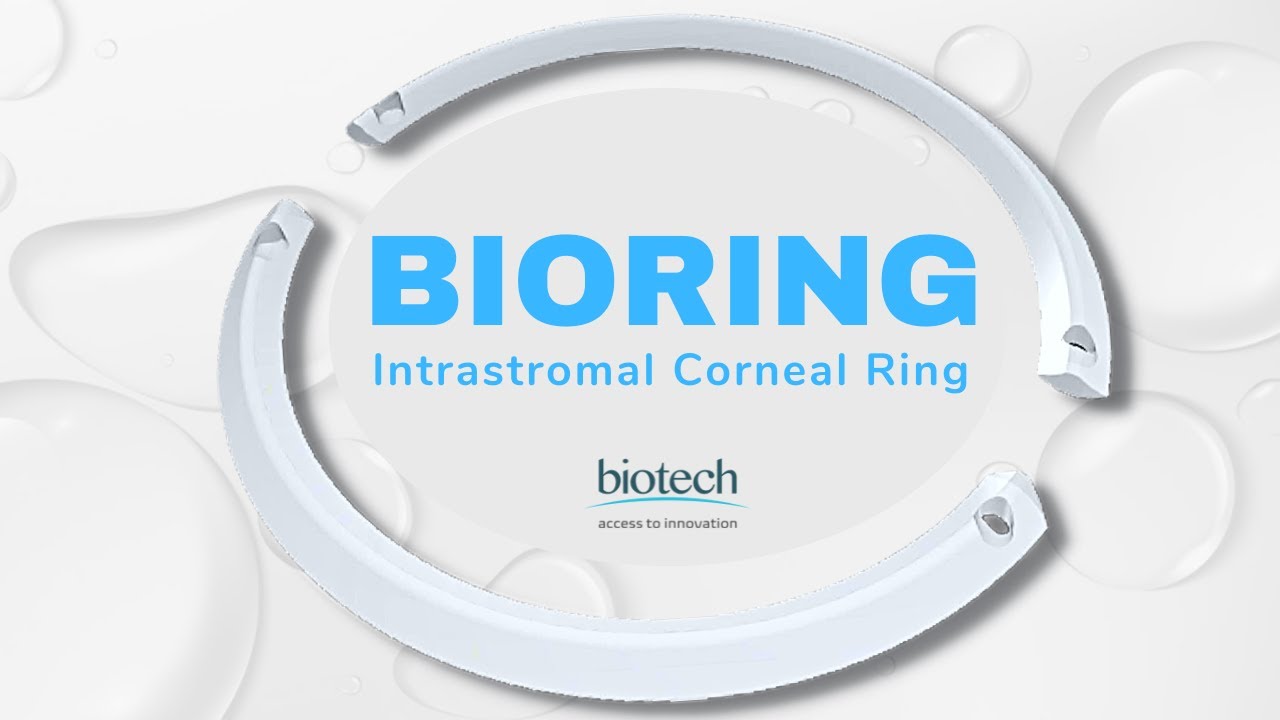Biotech BIORING , corneal transplantation eye surgery video