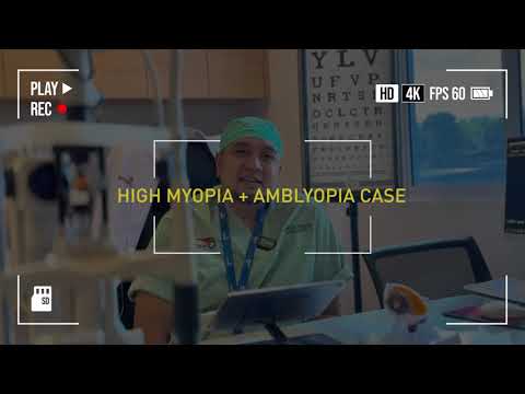 Challenging Intraocular Lens Cases: Clinical Perspectives with Dr. Tommy Tri Atmaja