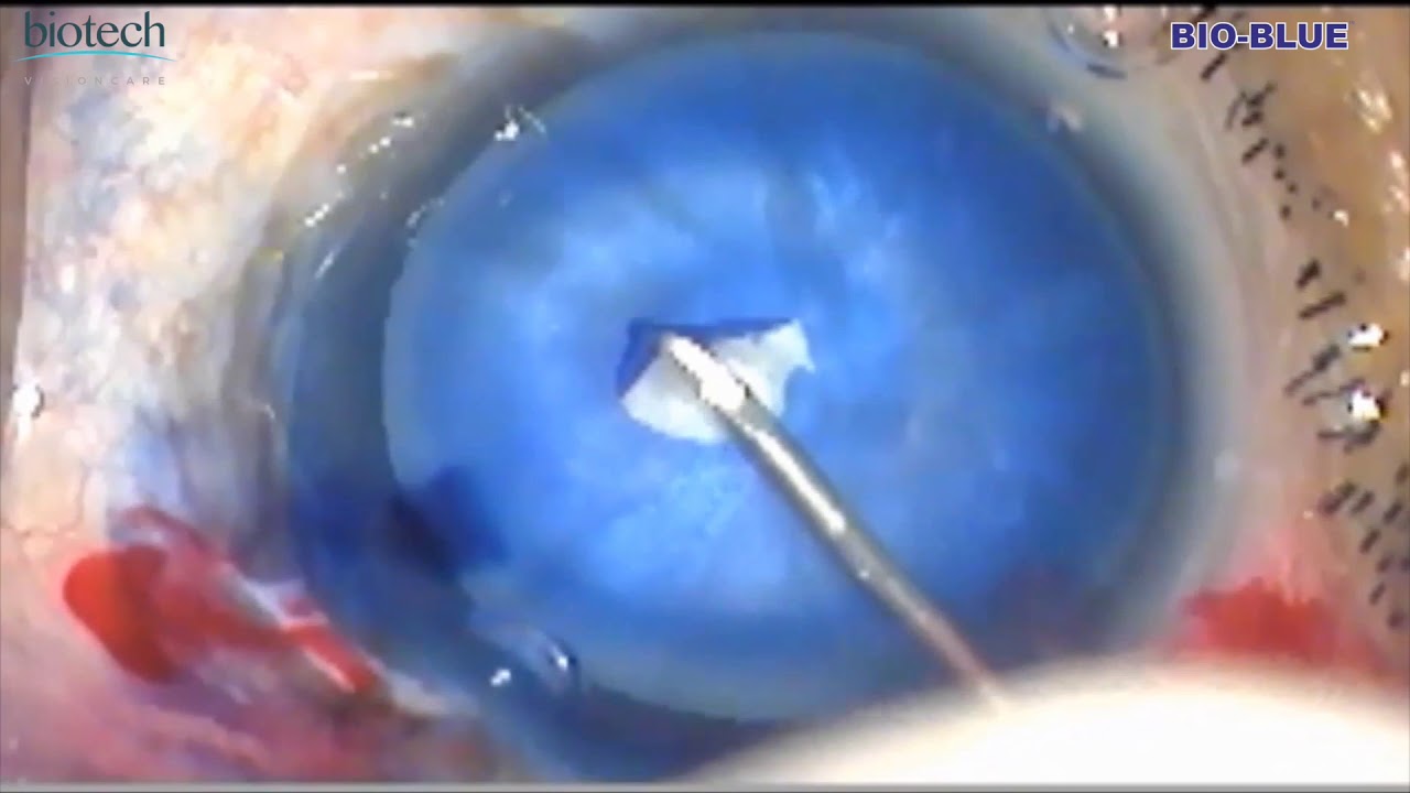 BioBlueHDvideo