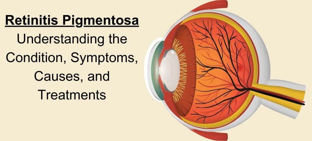 Retinitis Pigmentosa: Understanding the Condition, Symptoms, Causes, and Treatments