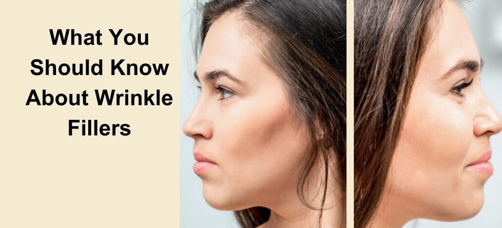 What You Should Know About Wrinkle Fillers