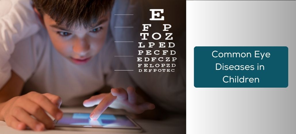 Common Eye Diseases in Children: Identification, Treatment, and Prevention Strategies