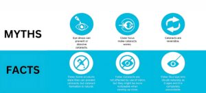 Debunking The Myths About Cataract Cataract Surgery Scaled