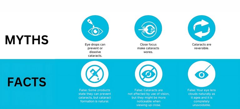 Debunking The Myths About Cataract Cataract Surgery Scaled