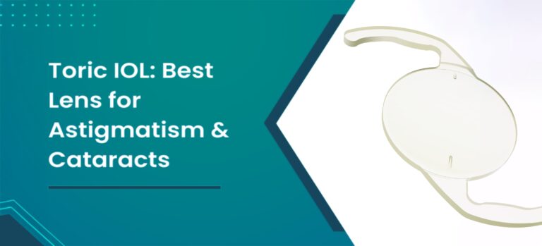 What Is A Toric Iol How Toric Iol Correct Astigmatism Scaled