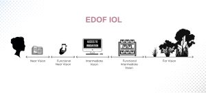 What Is An Edof Intraocular Lens And Who Can Benefit From It