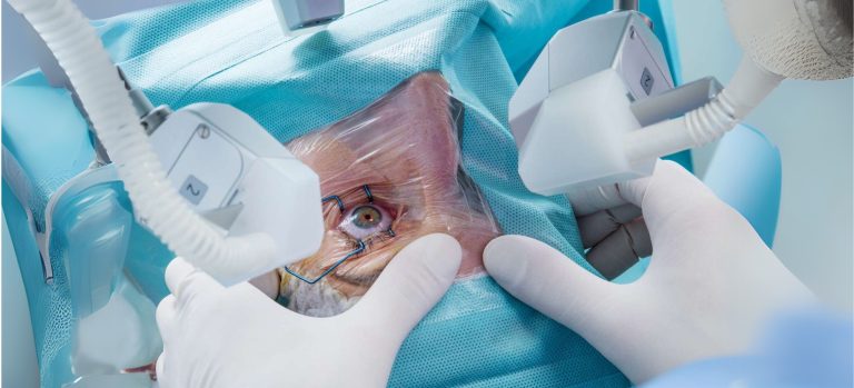 When Should I Have Cataract Surgery Scaled