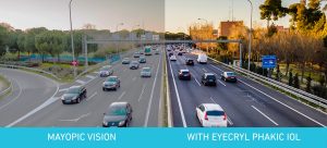 The Surprising Effect of Phakic Lenses on Contrast Sensitivity