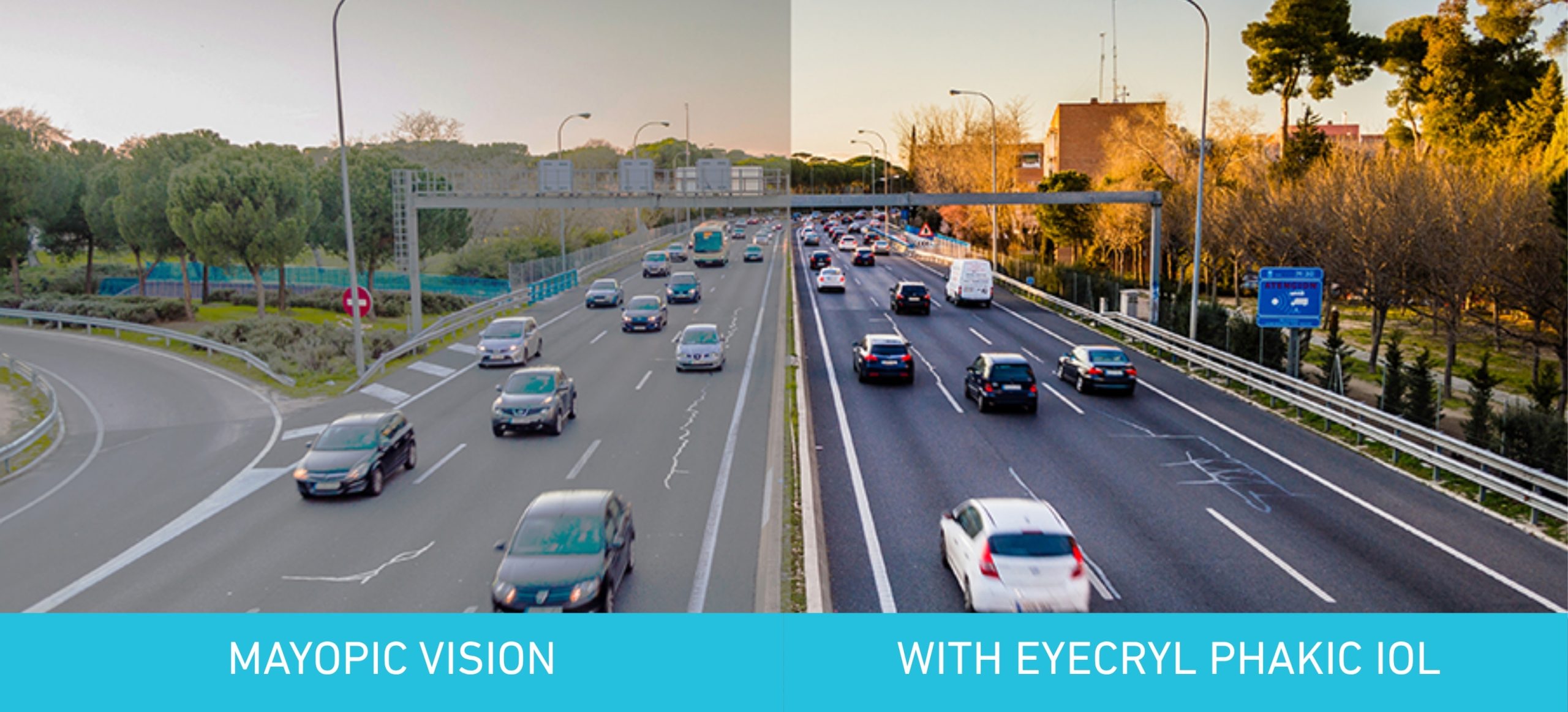 The Surprising Effect of Phakic Lenses on Contrast Sensitivity