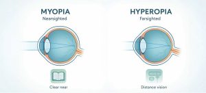 There is No Limit to High Myopia and Hyperopia How Many Powers Can Phakic Lenses Correct